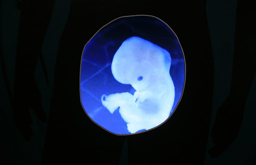 The logical slippery slope to human embryo factories begins with surrogacy and gamete sales &#8211; it