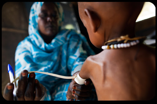 Nigeria &#8211; Amid the wealth of oil, children die of malnutrition &#8211; it