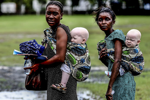 TANZANIA : Women carrying their albino children on May 5, 2014, in Dar es Salaam &#8211; it