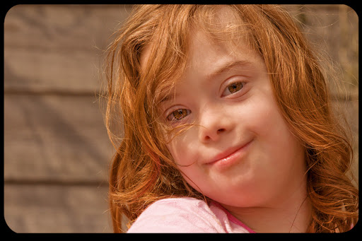 WEB Girl Downs Syndrome Andrea CC &#8211; it