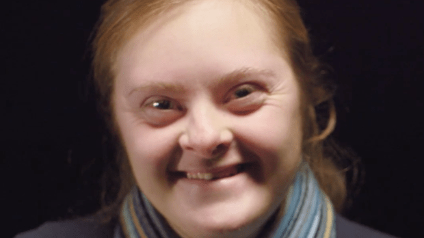 down syndrome girl