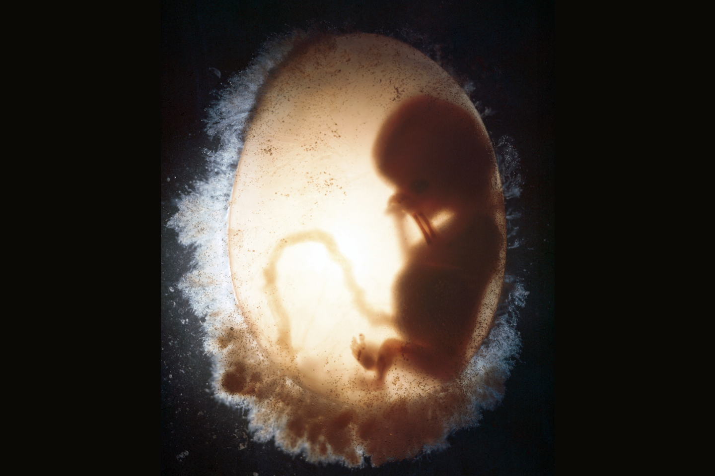 web-fetus-embryo-11-weeks-joo-lee-getty
