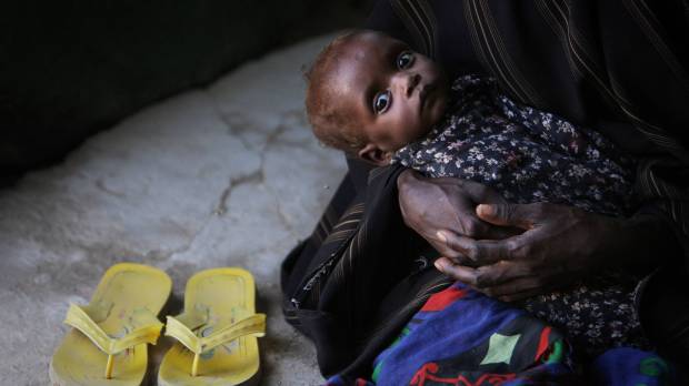 web-somalia-child-hunger-un-photo-stuart-price-cc