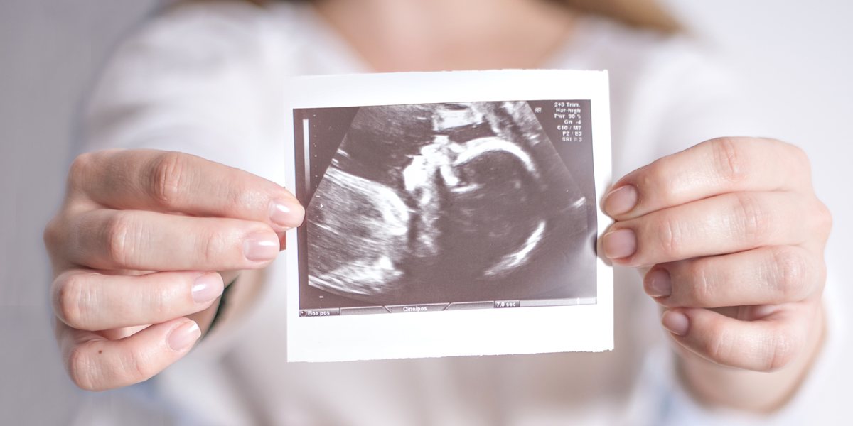 WOMAN,HANDS,ULTRASOUND,BABY,PREGNANT