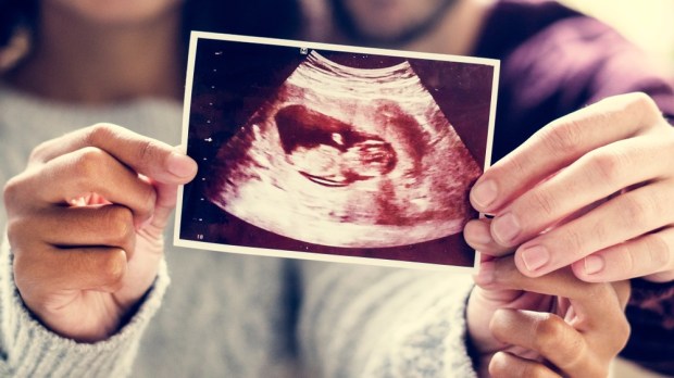 WEB-3-COUPLE-ULTRASOUND-IMAGE-BABY-PREGNANCY