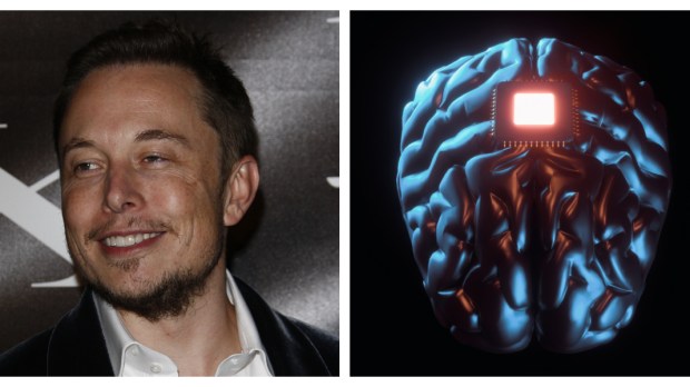 ELON MUSK, CHIP, BRAIN