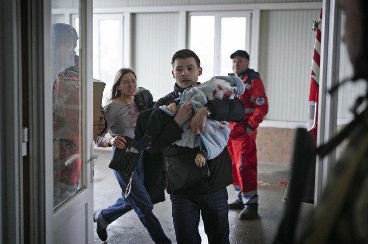 WAR; HOSPITAL; UKRAINE; LITTLE BOY